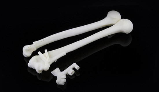 Ghiduri preoperatorii pentru osteotomie